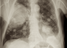 Is smoking 2-3 cigarettes a day normal?